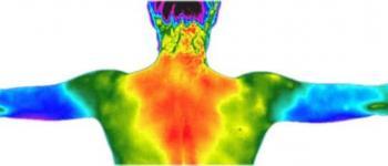 Thermografie